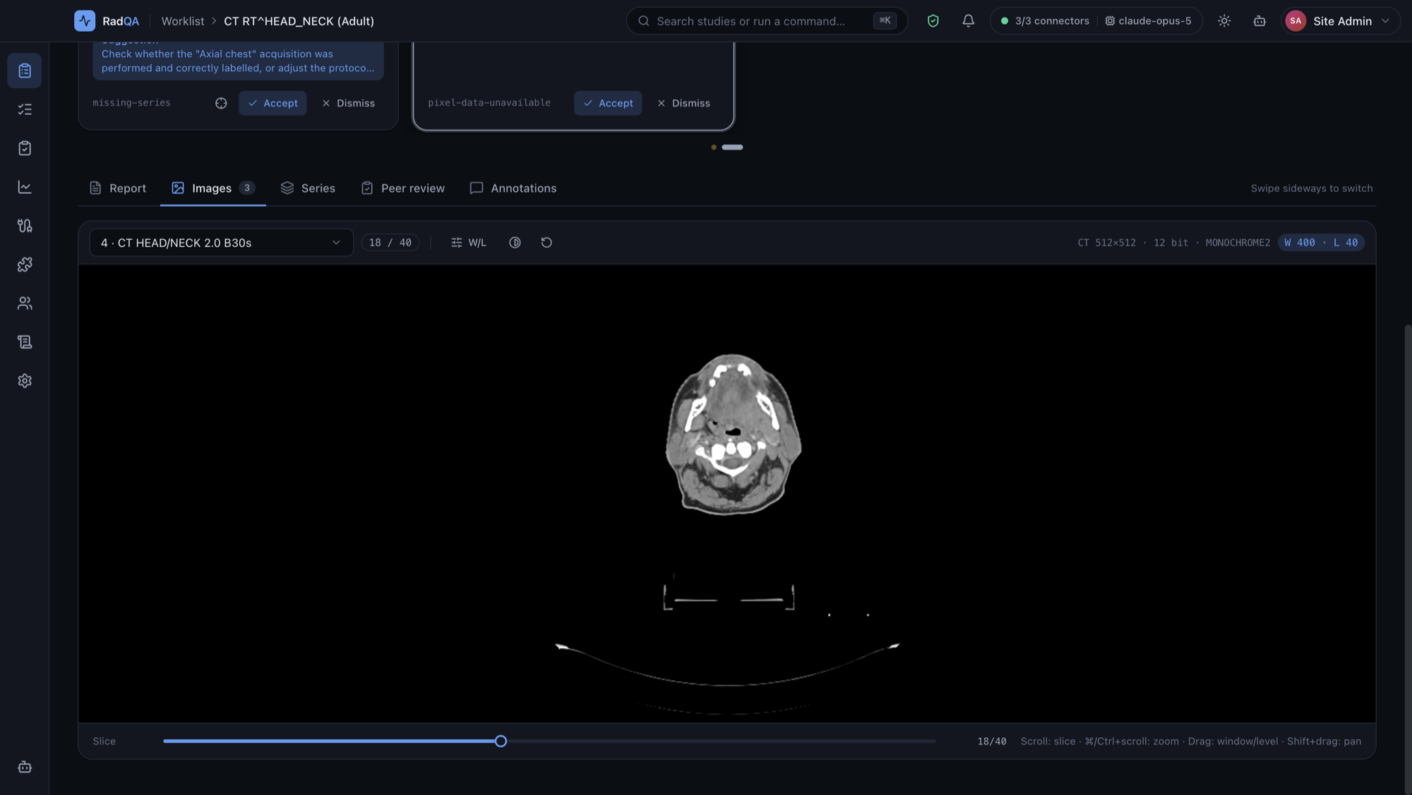 RadQA image viewer in dark mode showing slice 18 of a real head and neck CT
